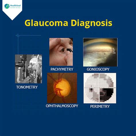 Diagnostic and Procedural Codes for Glaucoma and Glaucoma。